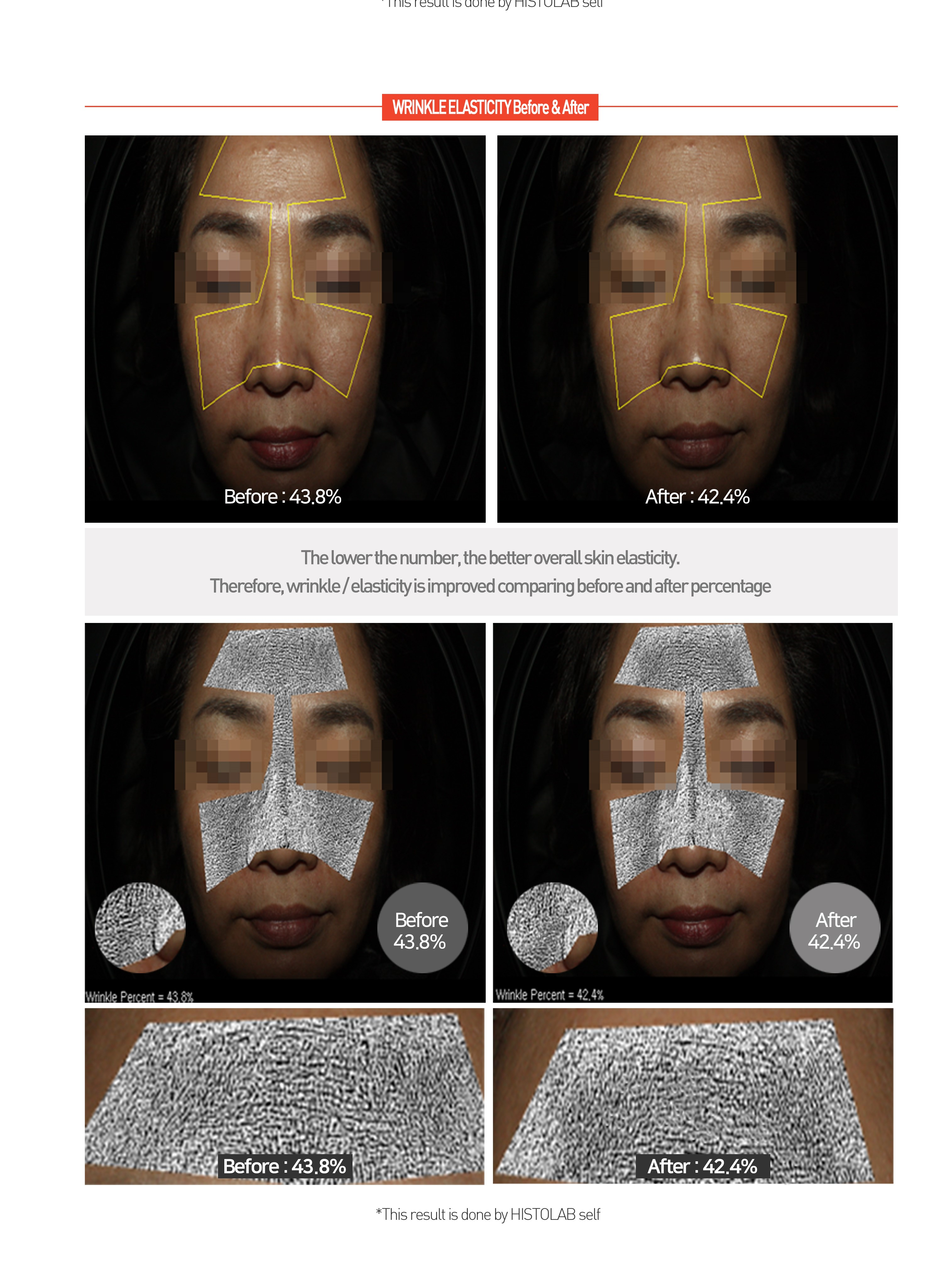 HYDROGEL REGENERATING CENTELLA CREAM (Sleeping Pack) - HistoLab Canada